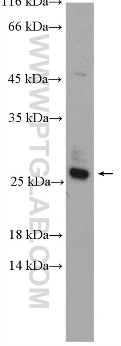 RAB14 Rabbit anti-Human, Mouse, Rat, Polyclonal, Proteintech 150 &mu;L;