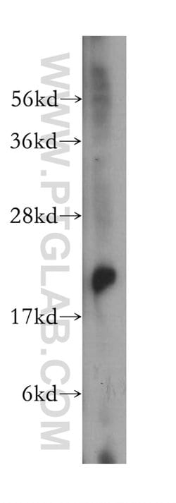 RAB14 Rabbit anti-Human, Mouse, Rat, Polyclonal, Proteintech 150 &mu;L;