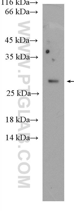 RAB14 Rabbit anti-Human, Mouse, Rat, Polyclonal, Proteintech 150 &mu;L;