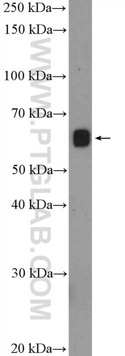 PHF1 Rabbit anti-Human, Mouse, Rat, Polyclonal, Proteintech 150 &mu;L;