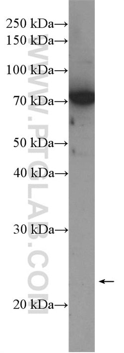 PHF1 Rabbit anti-Human, Mouse, Rat, Polyclonal, Proteintech 150 &mu;L;
