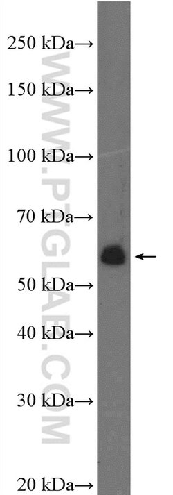 PHF1 Rabbit anti-Human, Mouse, Rat, Polyclonal, Proteintech 150 &mu;L;