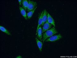ARHGAP9 Rabbit anti-Human, Polyclonal, Proteintech 150 &mu;L; Unconjugated:Antibodies,