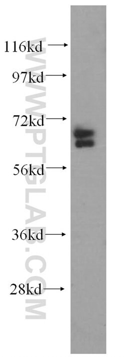 ARHGAP9 Rabbit anti-Human, Polyclonal, Proteintech 150 &mu;L; Unconjugated:Antibodies,