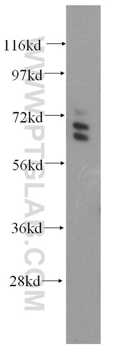 ARHGAP9 Rabbit anti-Human, Polyclonal, Proteintech 150 &mu;L; Unconjugated:Antibodies,