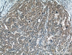 PMVK Rabbit anti-Human, Mouse, Rat, Polyclonal, Proteintech 20 &mu;L; Unconjugated:Antibodies,