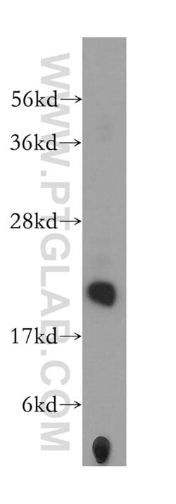 PMVK Rabbit anti-Human, Mouse, Rat, Polyclonal, Proteintech 20 &mu;L; Unconjugated:Antibodies,