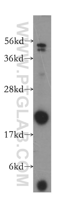 PMVK Rabbit anti-Human, Mouse, Rat, Polyclonal, Proteintech 20 &mu;L; Unconjugated:Antibodies,
