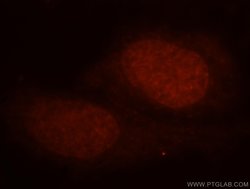 HEXIM1 Rabbit anti-Human, Mouse, Rat, Polyclonal, Proteintech 150 &mu;L;