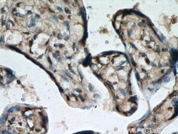 HEXIM1 Rabbit anti-Human, Mouse, Rat, Polyclonal, Proteintech 150 &mu;L;