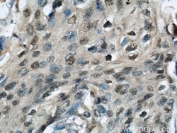 HEXIM1 Rabbit anti-Human, Mouse, Rat, Polyclonal, Proteintech 150 &mu;L;