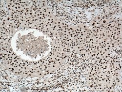 HEXIM1 Rabbit anti-Human, Mouse, Rat, Polyclonal, Proteintech 150 &mu;L;