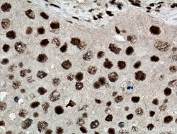 HEXIM1 Rabbit anti-Human, Mouse, Rat, Polyclonal, Proteintech 150 &mu;L;