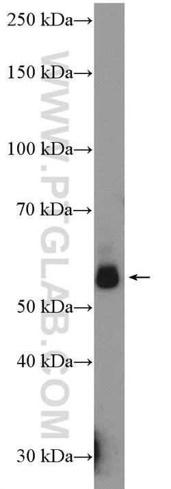 HEXIM1 Rabbit anti-Human, Mouse, Rat, Polyclonal, Proteintech 150 &mu;L;
