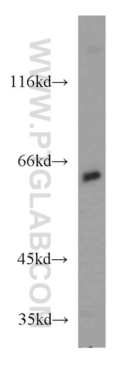 CDC45L Rabbit anti-Human, Mouse, Rat, Polyclonal, Proteintech 150 &mu;L;