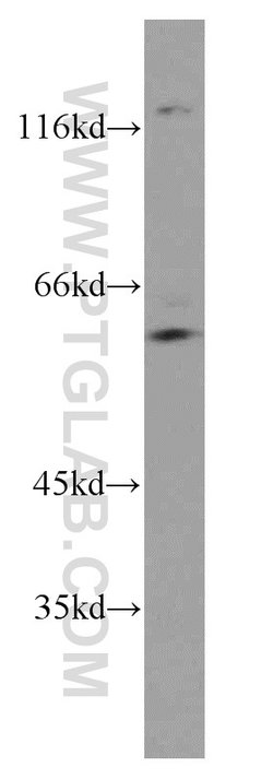 CDC45L Rabbit anti-Human, Mouse, Rat, Polyclonal, Proteintech 150 &mu;L;