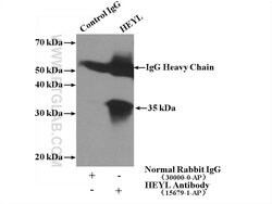 HEYL Rabbit anti-Human, Mouse, Rat, Polyclonal, Proteintech 20 &mu;L; Unconjugated:Antibodies,