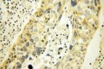 Thumbnail_MRPL45 Rabbit anti-Human, Mouse, Rat, Polyclonal, Proteintech:Anticuerpos:Anticuerpos