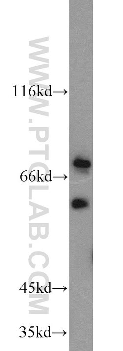ACSL5 Rabbit anti-Human, Mouse, Rat, Polyclonal, Proteintech 150 &mu;L;