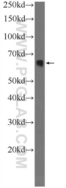 ACSL5 Rabbit anti-Human, Mouse, Rat, Polyclonal, Proteintech 150 &mu;L;