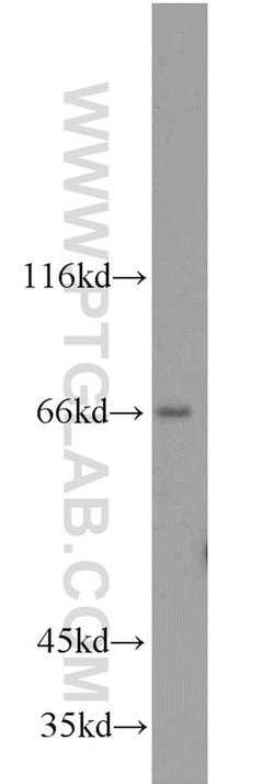 ACSL5 Rabbit anti-Human, Mouse, Rat, Polyclonal, Proteintech 150 &mu;L;