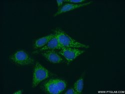 NARS2 Rabbit anti-Human, Mouse, Rat, Polyclonal, Proteintech:Antibodies:Primary