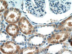 NARS2 Rabbit anti-Human, Mouse, Rat, Polyclonal, Proteintech:Antibodies:Primary