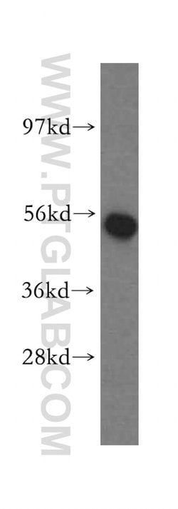 NARS2 Rabbit anti-Human, Mouse, Rat, Polyclonal, Proteintech:Antibodies:Primary