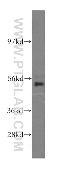 NARS2 Rabbit anti-Human, Mouse, Rat, Polyclonal, Proteintech:Antibodies:Primary