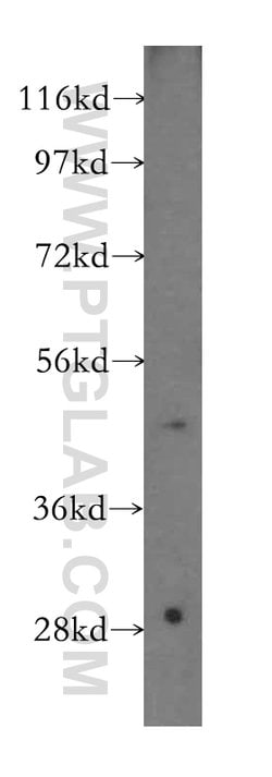 NARS2 Rabbit anti-Human, Mouse, Rat, Polyclonal, Proteintech:Antibodies:Primary