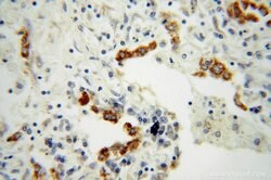 FMO2 Rabbit anti-Human, Mouse, Rat, Polyclonal, Proteintech:Antibodies:Primary