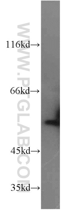 FMO2 Rabbit anti-Human, Mouse, Rat, Polyclonal, Proteintech:Antibodies:Primary