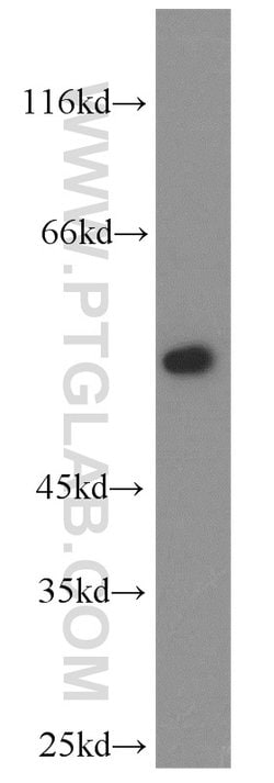 FMO2 Rabbit anti-Human, Mouse, Rat, Polyclonal, Proteintech:Antibodies:Primary