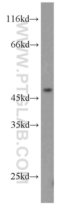 TRIM14 Rabbit anti-Human, Polyclonal, Proteintech 150 &mu;L; Unconjugated:Antibodies,
