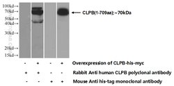 CLPB Rabbit anti-Human, Mouse, Rat, Polyclonal, Proteintech:Antibodies:Primary