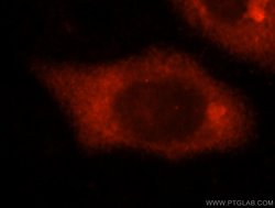 SLC7A4 Rabbit anti-Human, Polyclonal, Proteintech:Antibodies:Primary Antibodies