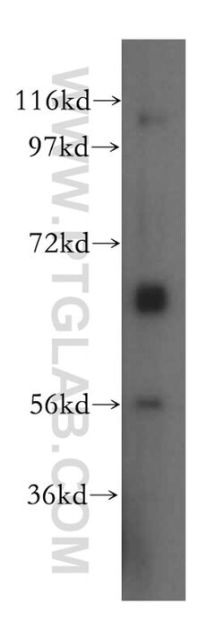 SLC7A4 Rabbit anti-Human, Polyclonal, Proteintech:Antibodies:Primary Antibodies