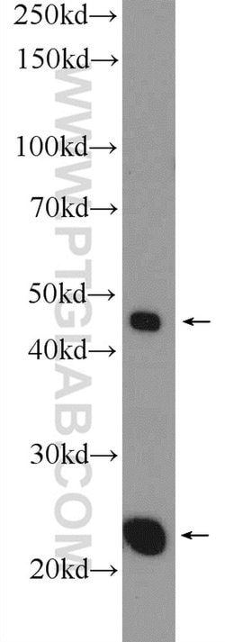 MID1IP1 Rabbit anti-Human, Mouse, Rat, Polyclonal, Proteintech 150 &mu;L;