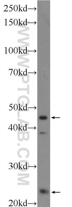 MID1IP1 Rabbit anti-Human, Mouse, Rat, Polyclonal, Proteintech 150 &mu;L;