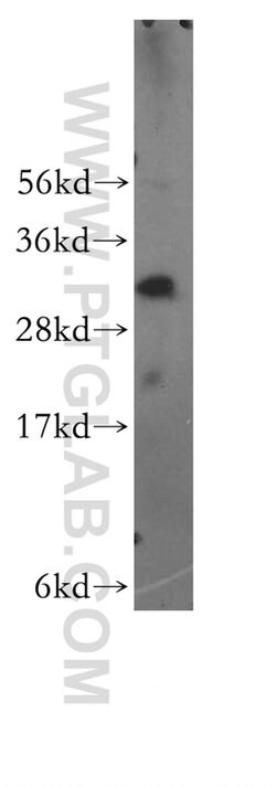 NMRAL1 Rabbit anti-Human, Mouse, Rat, Polyclonal, Proteintech 150 μL;