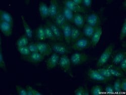 DDX24 Rabbit anti-Human, Mouse, Rat, Polyclonal, Proteintech 150 &mu;L;