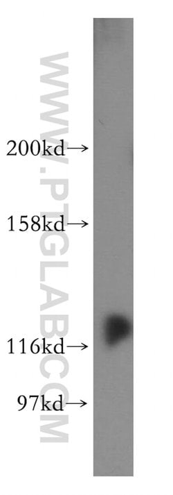 DDX24 Rabbit anti-Human, Mouse, Rat, Polyclonal, Proteintech 150 &mu;L;