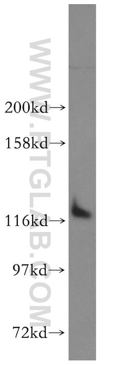 DDX24 Rabbit anti-Human, Mouse, Rat, Polyclonal, Proteintech 150 &mu;L;
