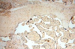 VAC14 Rabbit anti-Human, Mouse, Rat, Polyclonal, Proteintech 150 &mu;L;