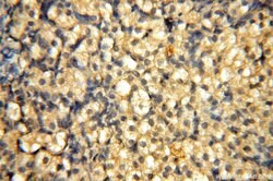 VAC14 Rabbit anti-Human, Mouse, Rat, Polyclonal, Proteintech 150 &mu;L;