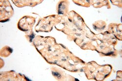 VAC14 Rabbit anti-Human, Mouse, Rat, Polyclonal, Proteintech 150 &mu;L;