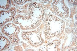 VAC14 Rabbit anti-Human, Mouse, Rat, Polyclonal, Proteintech 150 &mu;L;
