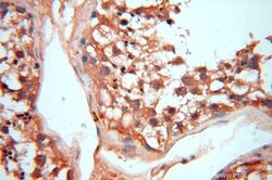 VAC14 Rabbit anti-Human, Mouse, Rat, Polyclonal, Proteintech 150 &mu;L;