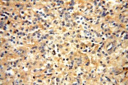 VAC14 Rabbit anti-Human, Mouse, Rat, Polyclonal, Proteintech 150 &mu;L;