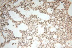 VAC14 Rabbit anti-Human, Mouse, Rat, Polyclonal, Proteintech 150 &mu;L;